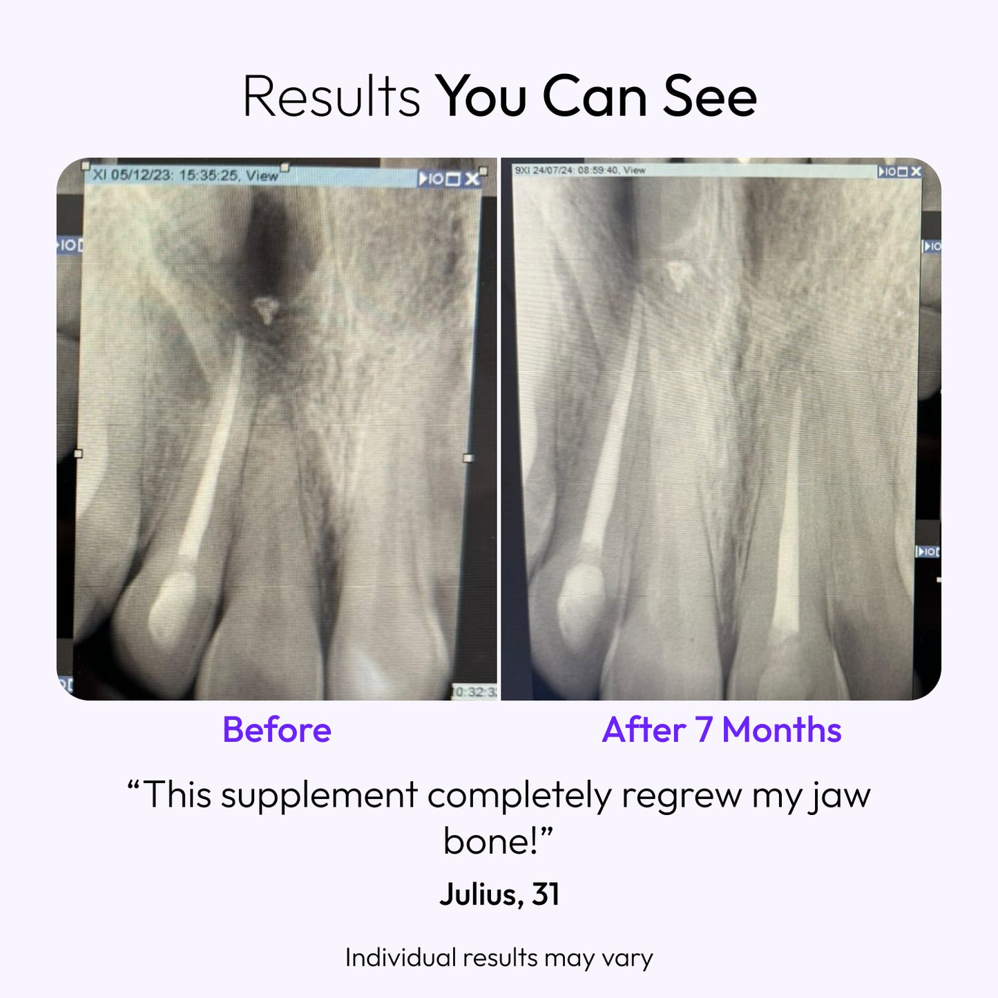 Tooth Restore: Complete Tooth & Jaw Health Supplement